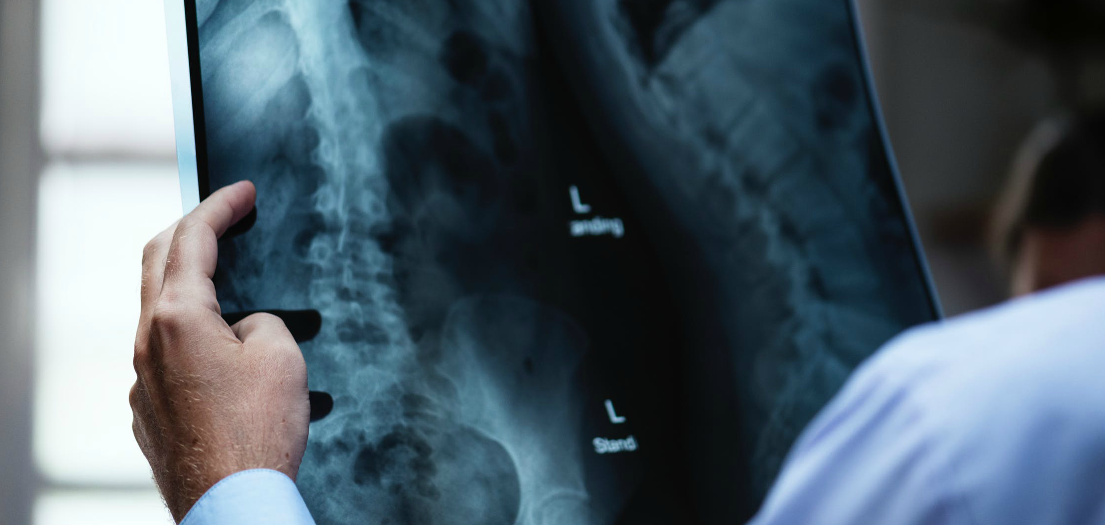 Assessment of lumbar spine forces during maneuvering of different lift devices during patient handling